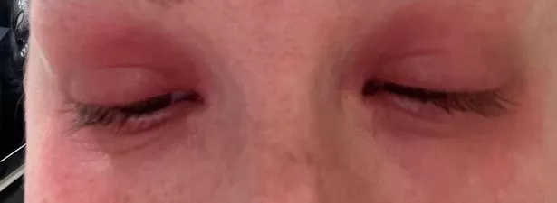 母亲对自己的月经过敏,痛苦地离开了